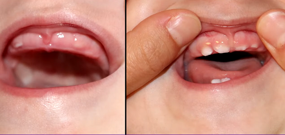 Baby Teething Tips