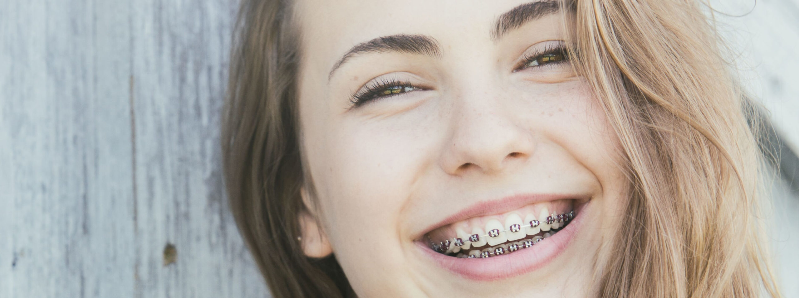 Black Braces