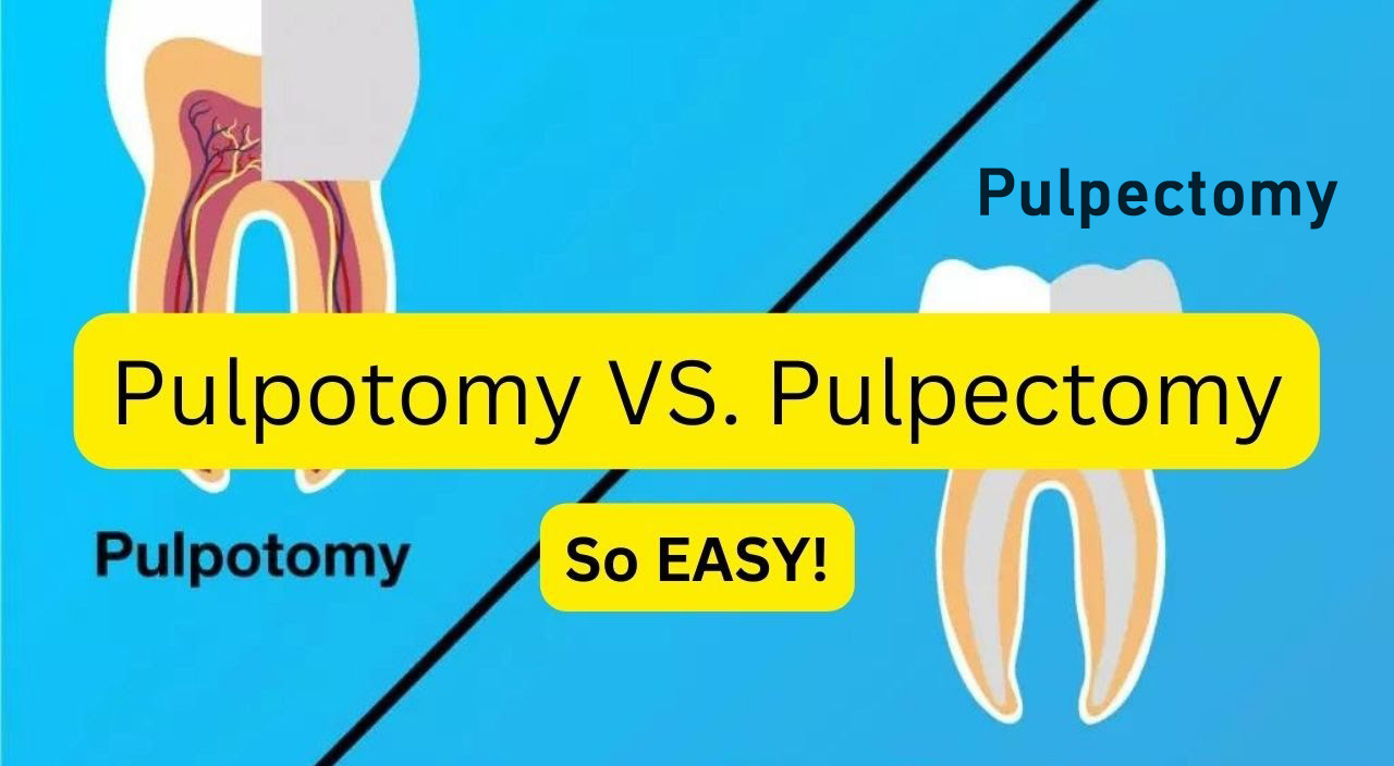 Pulpotomy vs Pulpectomy